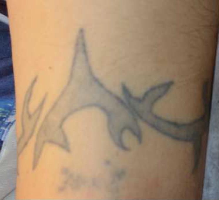 Il tatuaggio sul braccio