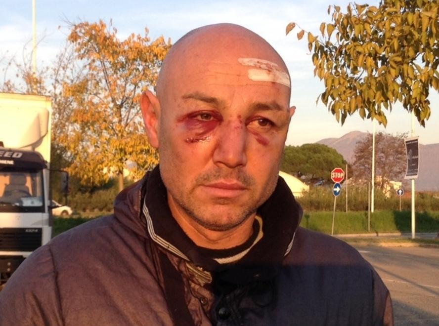 È in fila per un panino aggredito a colpi di Kung Fu 