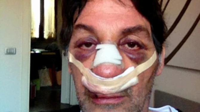 Un 59enne di Cavriago pestato a sangue a Parma