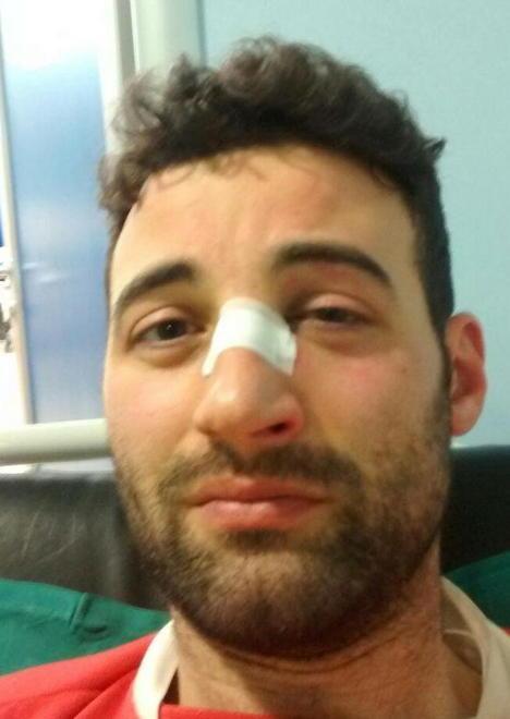 Calciatore picchiato durante la partita