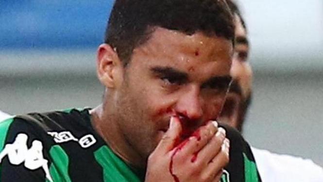 Defrel operato al naso, è in forse per Torino A rischio anche Biondini: oggi accertamenti