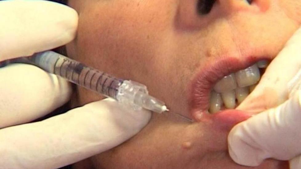 Il botulino le devasta il viso, ma il medico viene assolto