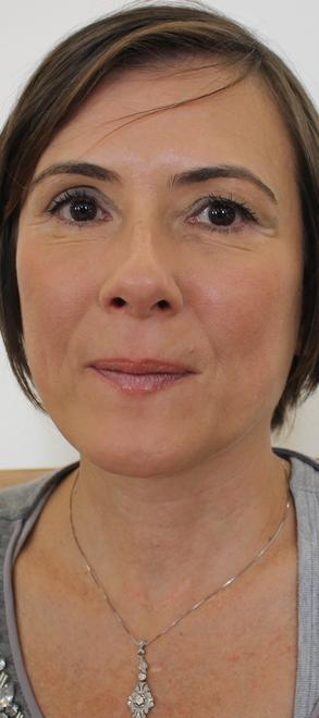 Campra: San Giuseppe nel degrado totale 