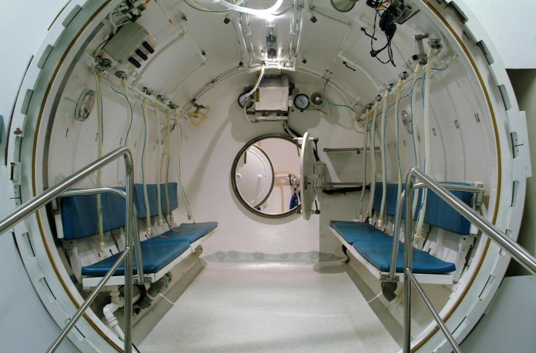 Tre persone intossicate dal monossido di carbonio