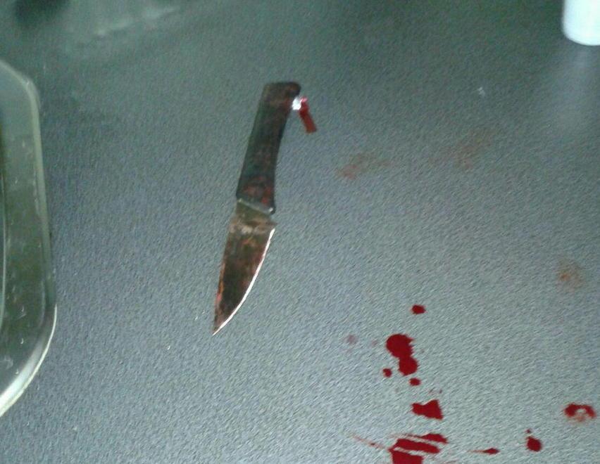 Accoltella il compagno, arrestata 