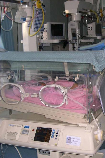 Muore neonato, era stato appena dimesso dall’ospedale 