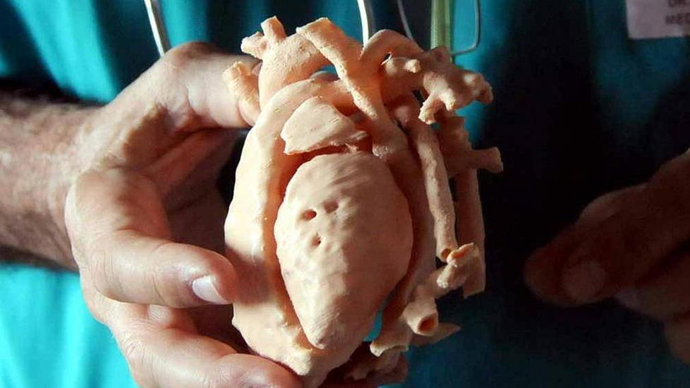 Il cuore della piccola in 3d