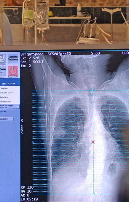Stop alla radiologia fino a settembre 