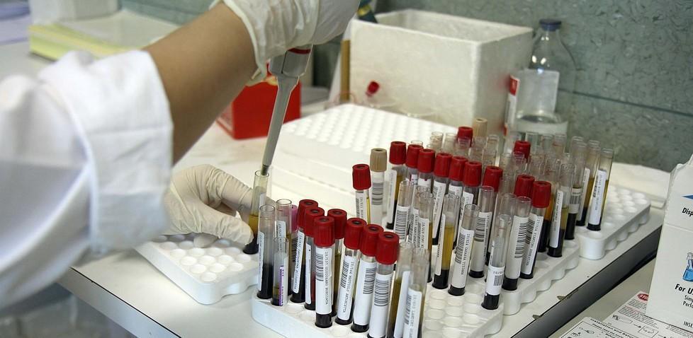 Sangue infetto: il Tar impone indennizzo a favore di un paziente modenese 