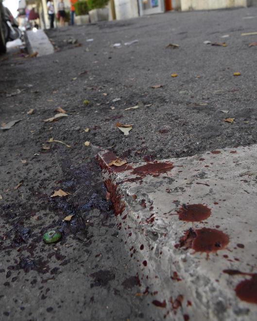 Massacrato di botte in pieno centro 
