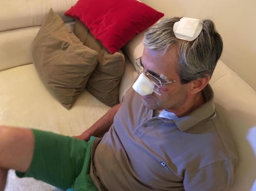 Aggredito, ora dovrà essere operato 