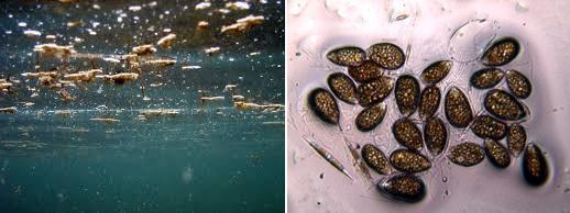 L'alga tossica Ostreopsis Ovata in mare e al microscopio