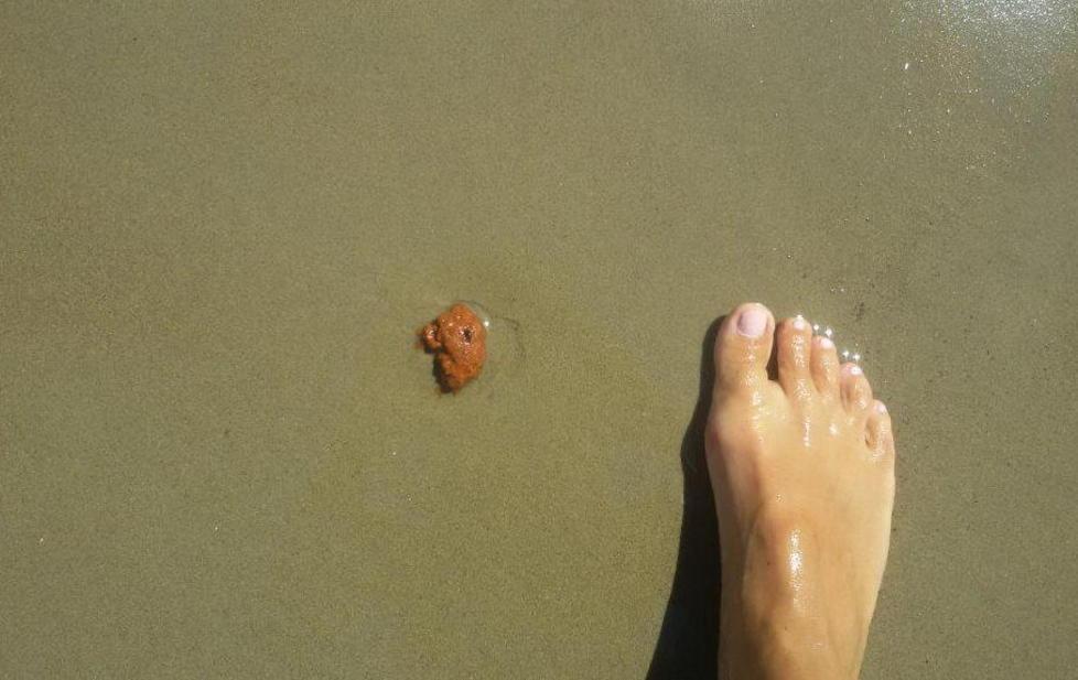 Aiuto, spuntano escrementi in riva al mare 