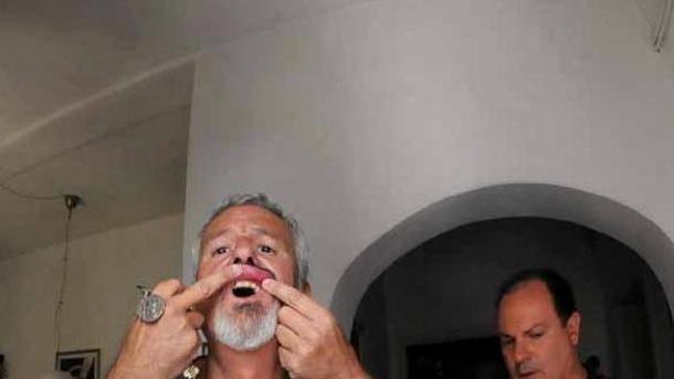 Aggredito il consigliere Benedetti Pastore lo picchia dopo un post
