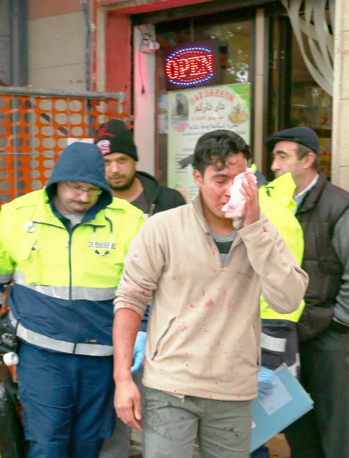 Lo scambia per rapinatore: rissa con pugni e coltellata 