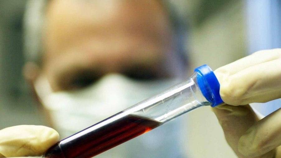 «Pochi medici, ematologia già in crisi»