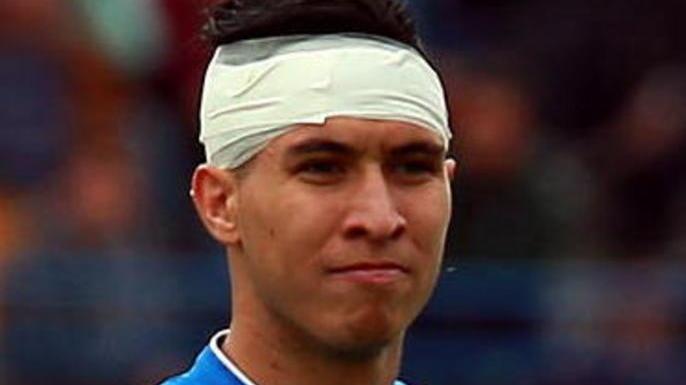 Forfait di Josè Mauri Cosic e Barba si giocano una maglia