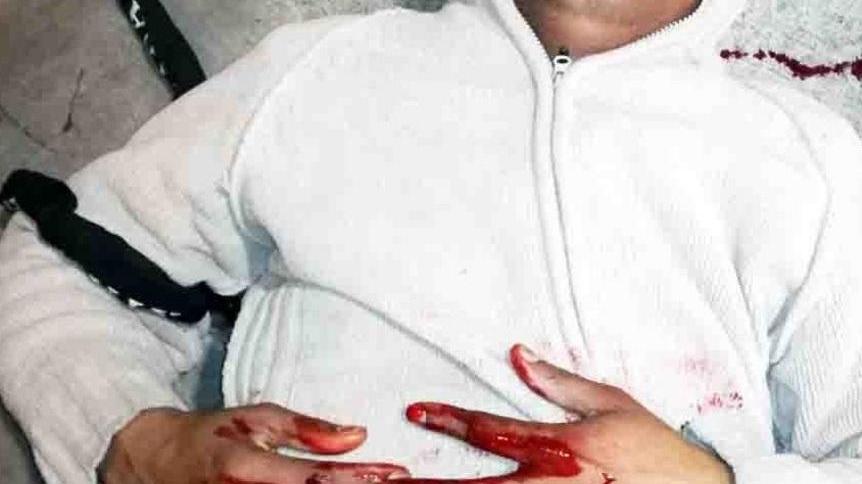 Picchiato con pugni, calci e una catena, è in prognosi riservata al S.Anna