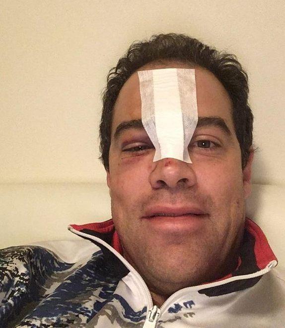Ghilarducci: «Il casco mi ha salvato la vita»