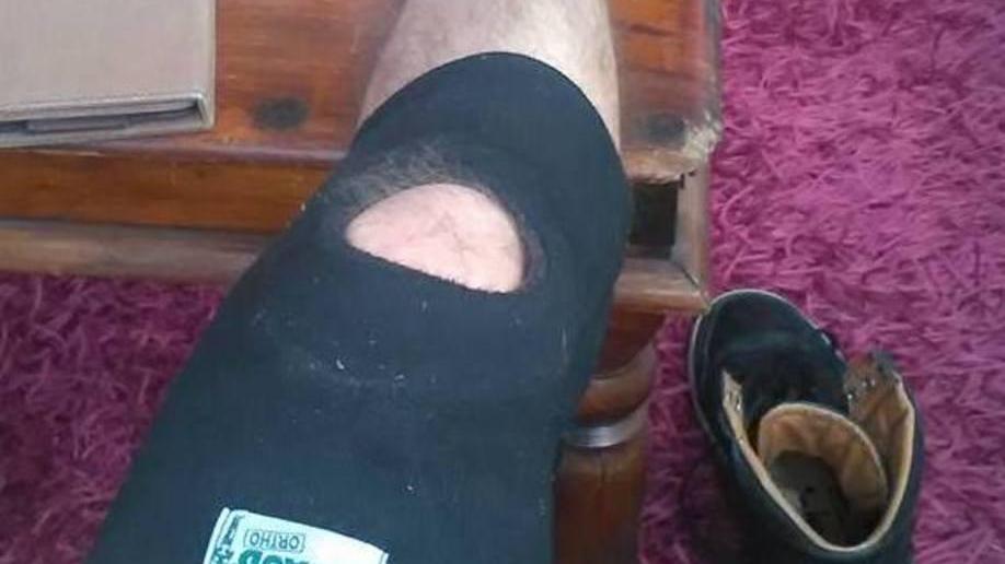 Blitz della “Iena” alla municipale, denunciato