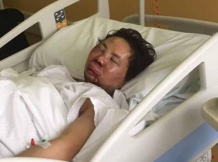 Il barista rapinato con pestaggio resta ricoverato: «Terrorizzati»