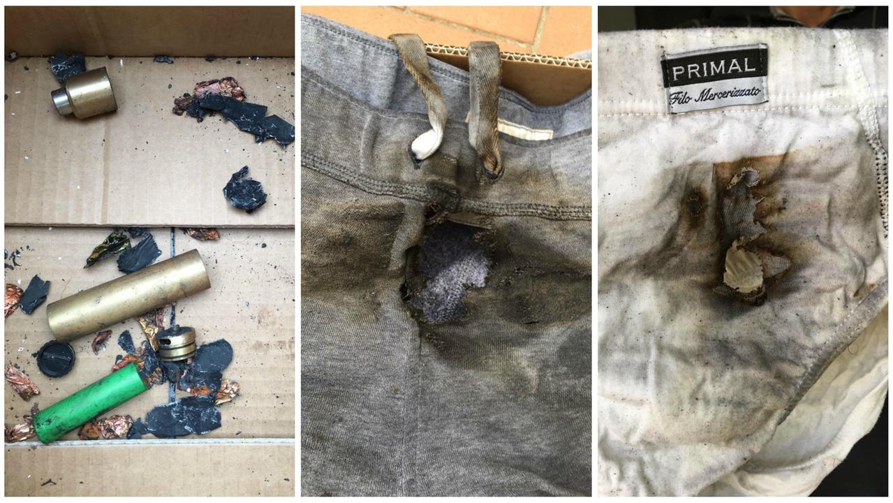 Da sinistra: i resti del "tubo" dopo l'esplosione, le bruciature a pantaloni e mutande perforati dal botto