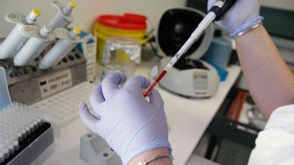 PARLIAMONE - La sanità paralizzata dai reagenti: a Sassari succede