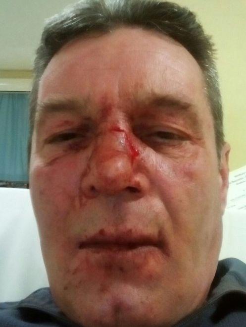 Castelnuovo «Io, picchiato dopo un incidente» 