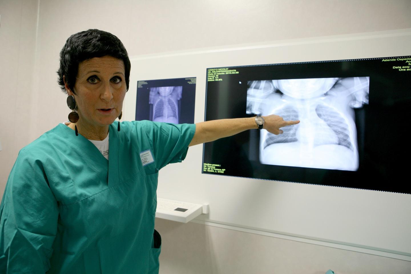 Rischia di soffocare, bimba salvata 