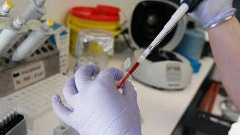 Calano i vaccini, cresce il morbillo