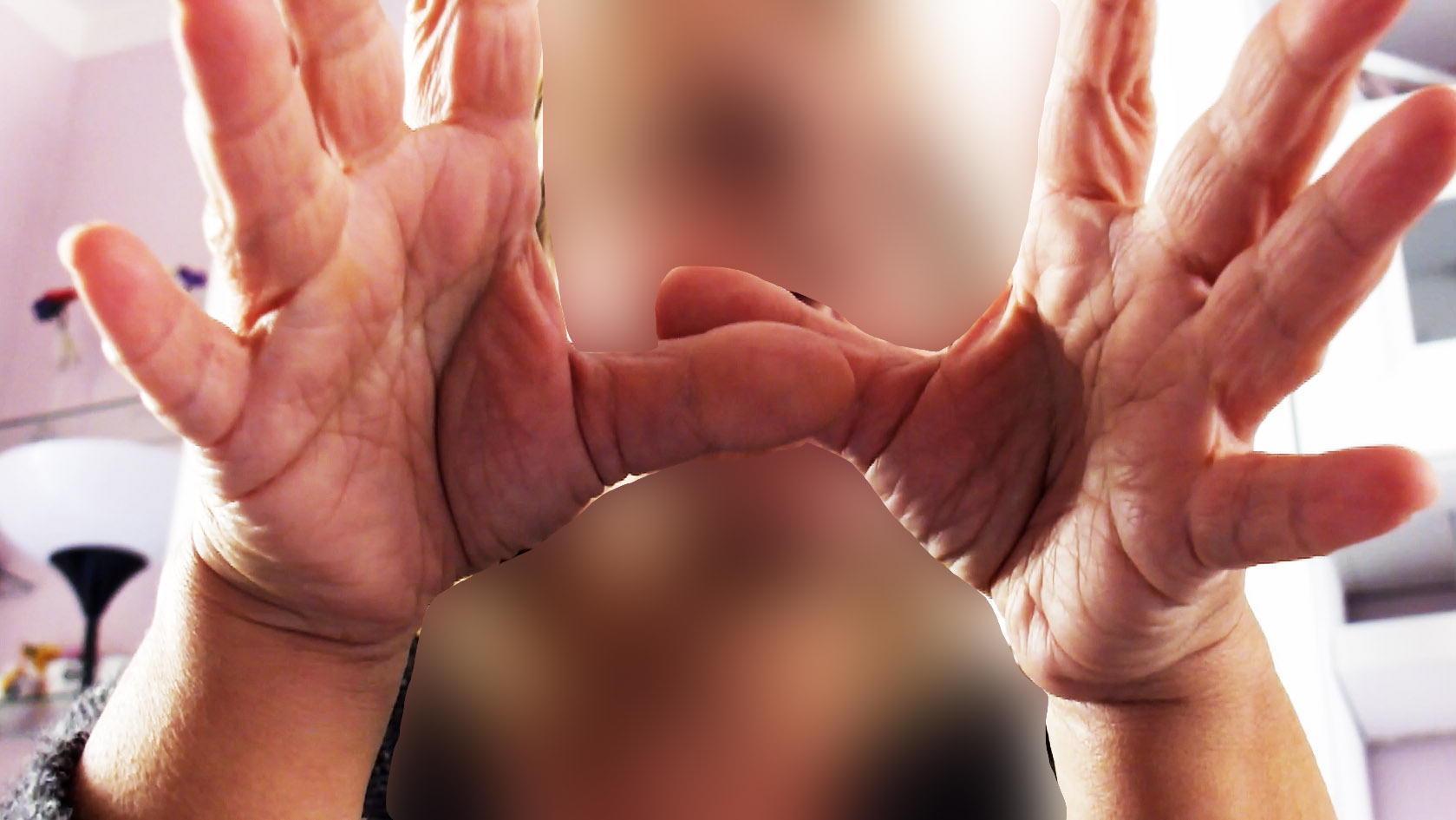 Maltrattavano un disabile, ecco chi sono gli operatori arrestati 