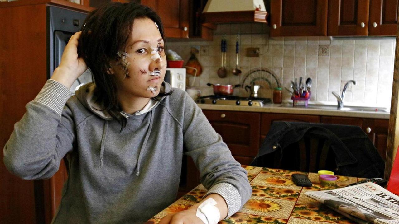 «Era fuori di testa: mi ha presa a pugni in faccia, non si fermava più»