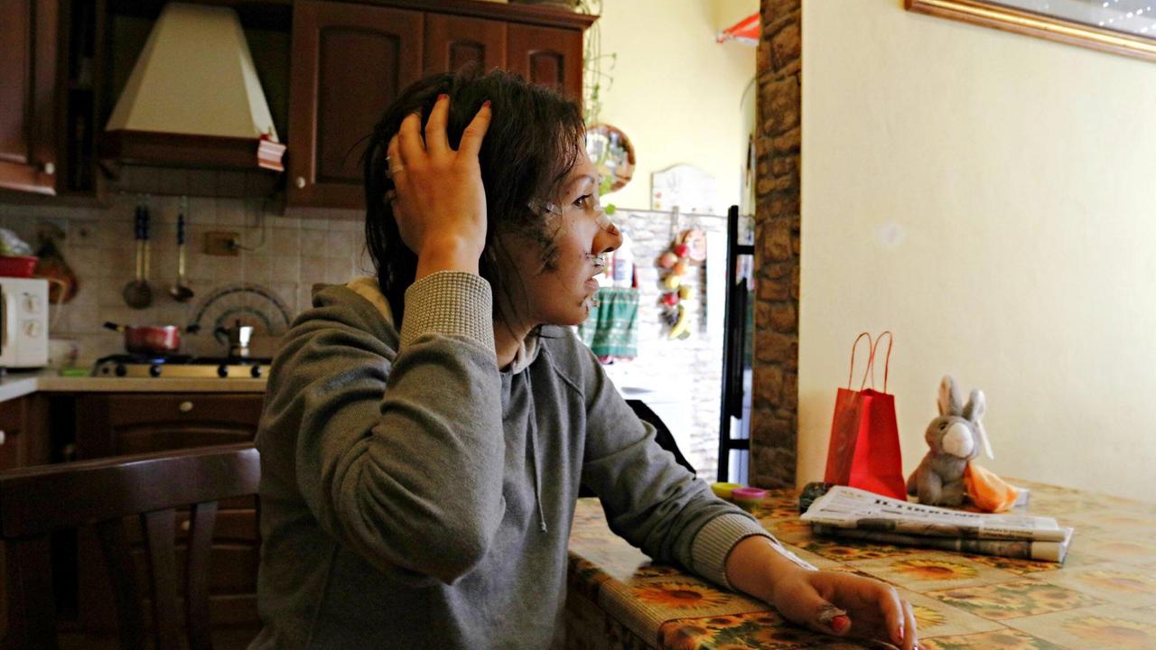 Sfregiata sotto casa, resta in carcere il marito violento