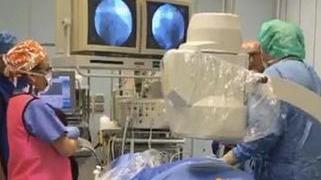 Curare la fibrillazione atriale con una tecnica innovativa