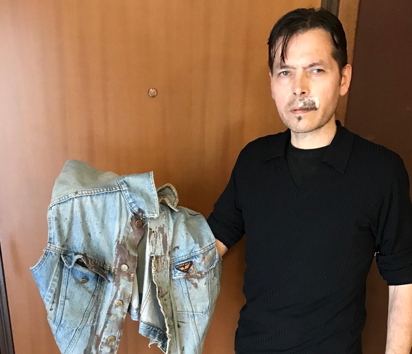 «Colpito da un pugno forse è “knockout game”» 