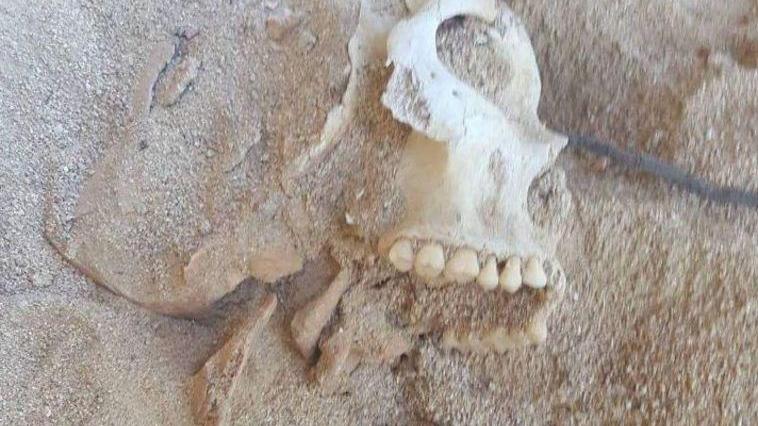 I resti di uno scheletro ritrovati in una spiaggia a Santa Teresa 