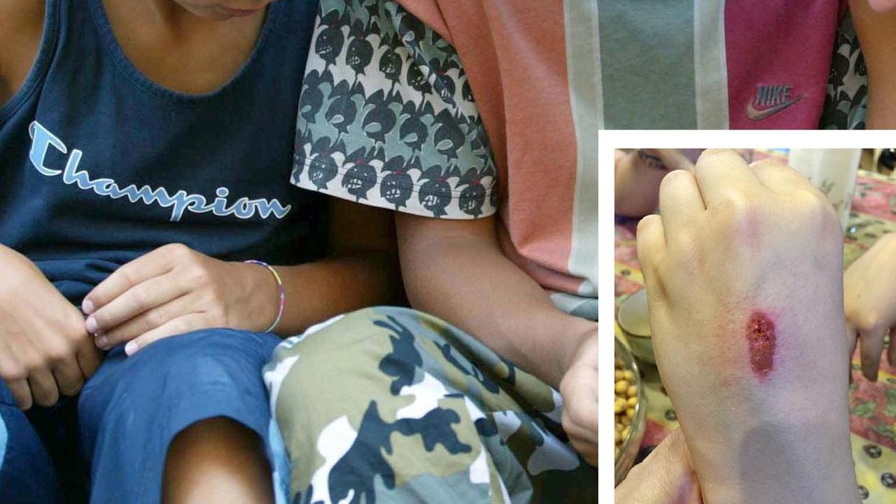 Ragazzini si sfidano a chi resiste di più al dolore