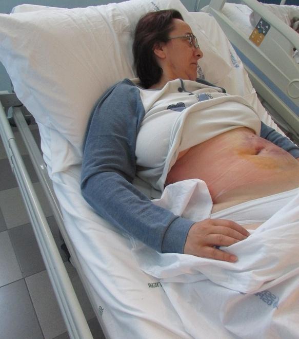 Elena Cristina Babei all'ospedale: evidente l'ematoma all'addome