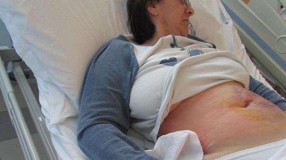 Elena Cristina Babei all'ospedale: evidente l'ematoma all'addome