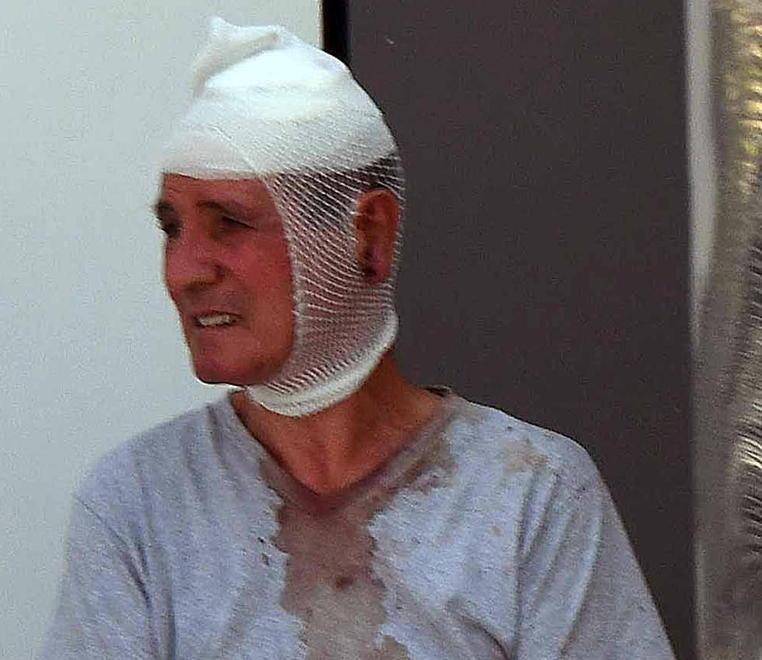 «Mi voleva ammazzare, mi colpiva pure a terra» 