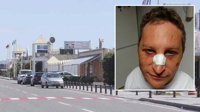 Pestato brutalmente davanti al Pappafico: "Nessuno in mio aiuto"
