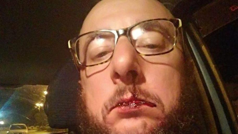 Dj pestato in piazza, aggressori incastrati dai post su Facebook