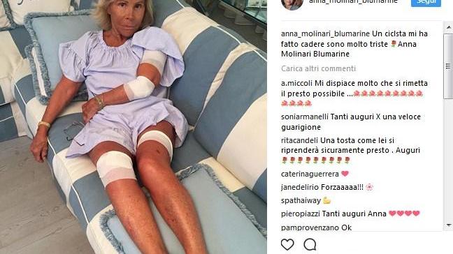 Scontro tra bici, ferita la stilista Molinari