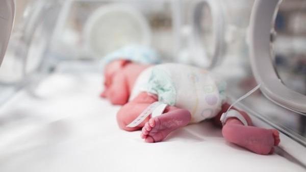 Neonatologia del Policlinico punto di riferimento nella diagnosi della paralisi cerebrale