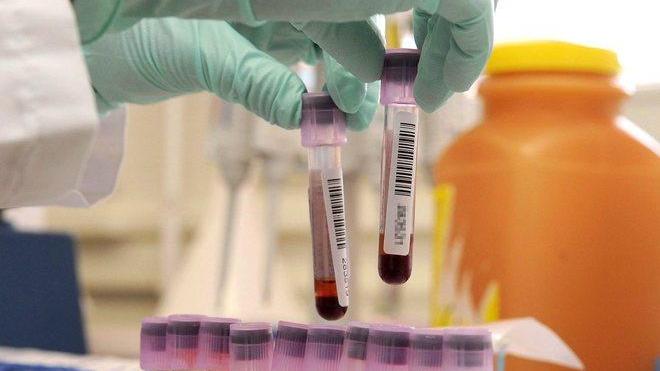 Un evento raro ma sempre possibile utile fare prima le analisi del sangue