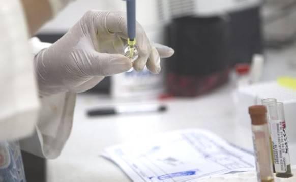 Analisi di laboratorio: accertato a Modena un caso di infezione da virus Zika