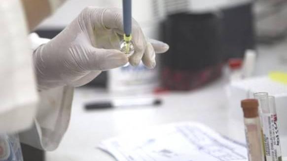 Analisi di laboratorio: accertato a Modena un caso di infezione da virus Zika