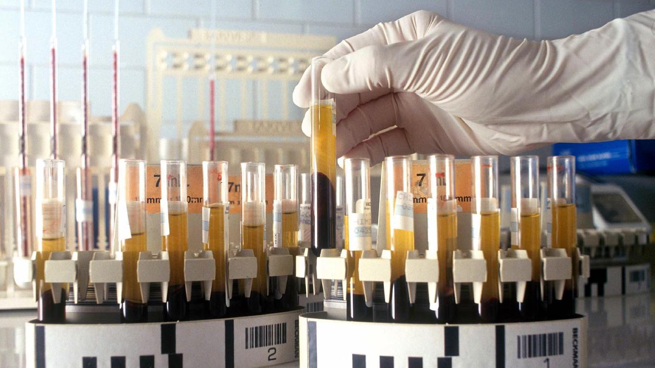 Suda sangue dal viso e dalle mani, 21enne afflitta da una rara malattia