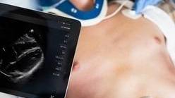 VIA LIBERA NEGLI USA A UN NUOVO APPARECCHIO