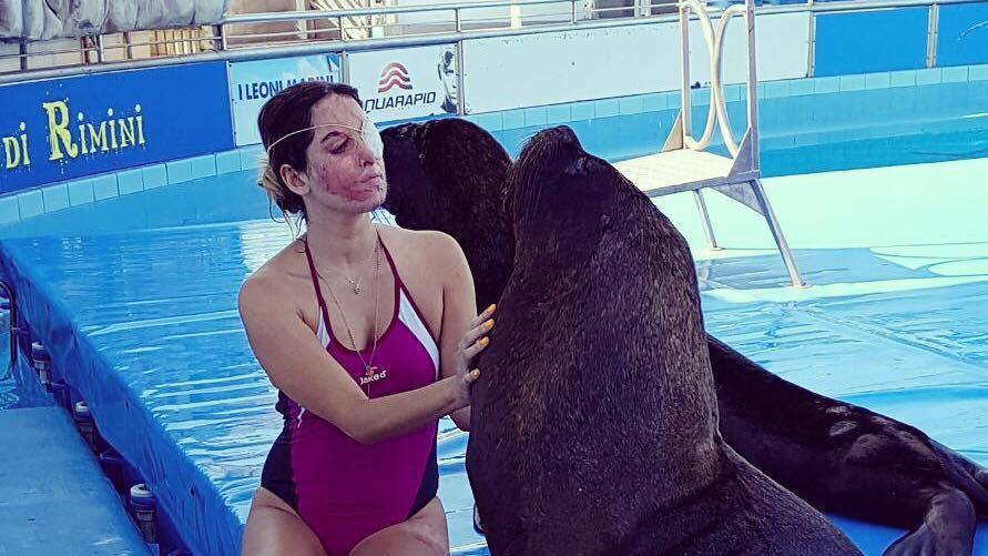 Gessica Notaro: "Per sconfiggere gli stalker dateci quei braccialetti"